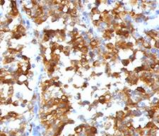 MLANA / Melan-A Antibody -  This image was taken for the unmodified form of this product. Other forms have not been tested.