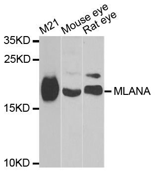 MLANA / Melan-A Antibody - Western blot analysis of extracts of various cell lines, using MLANA antibody.