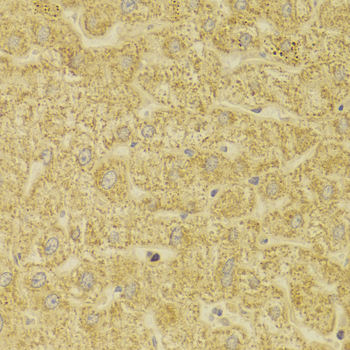 MLANA / Melan-A Antibody - Immunohistochemistry of paraffin-embedded Human liver injury tissue.