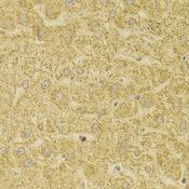 MLANA / Melan-A Antibody - Immunohistochemistry of paraffin-embedded Human liver injury tissue.