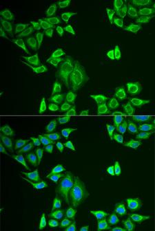MLANA / Melan-A Antibody - Immunofluorescence analysis of U2OS cells.