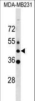 MLC1 / MLC Antibody - MLC1 Antibody western blot of MDA-MB231 cell line lysates (35 ug/lane). The MLC1 antibody detected the MLC1 protein (arrow).