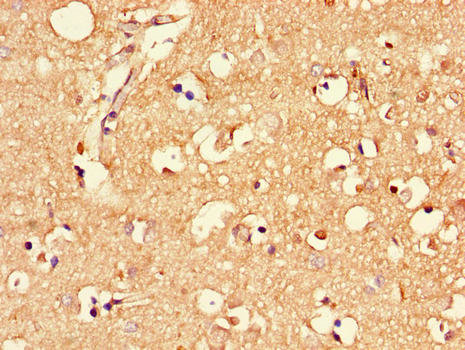 MLC1 / MLC Antibody - Immunohistochemistry of paraffin-embedded human brain tissue using MLC1 Antibody at dilution of 1:100
