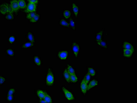 MLC1 / MLC Antibody - Immunofluorescent analysis of HepG2 cells using MLC1 Antibody at a dilution of 1:100 and Alexa Fluor 488-congugated AffiniPure Goat Anti-Rabbit IgG(H+L)