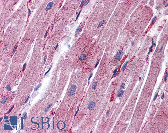 MLC2 / MYL9 Antibody - Anti-MYL9 antibody IHC of human heart. Immunohistochemistry of formalin-fixed, paraffin-embedded tissue after heat-induced antigen retrieval. Antibody concentration 5 ug/ml.  This image was taken for the unconjugated form of this product. Other forms have not been tested.