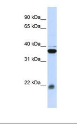 MLC2 / MYL9 Antibody - Jurkat cell lysate. Antibody concentration: 1.0 ug/ml. Gel concentration: 12%.  This image was taken for the unconjugated form of this product. Other forms have not been tested.