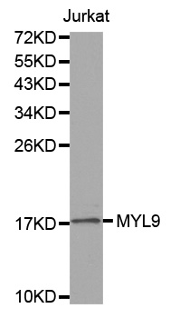 MLC2 / MYL9 Antibody - Western blot analysis of extracts of Jurkat cell line, using MYL9 antibody.