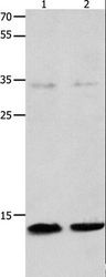 MLC2 / MYL9 Antibody - Western blot analysis of Jurkat and 231 cell, using MYL9 Polyclonal Antibody at dilution of 1:1500.