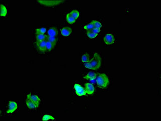 MLC2 / MYL9 Antibody - Immunofluorescent analysis of MCF-7 cells using MYL9 Antibody at a dilution of 1:100 and Alexa Fluor 488-congugated AffiniPure Goat Anti-Rabbit IgG(H+L)