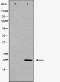 MLC2 / MYL9 Antibody - Western blot analysis of MRLC2 expression in K562 cells extract. The lane on the left is treated with the antigen-specific peptide.