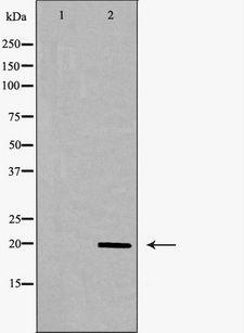 MLC2 / MYL9 Antibody - Western blot analysis of MRLC2 expression in K562 cells extract. The lane on the left is treated with the antigen-specific peptide.