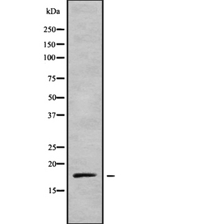 MLC2 / MYL9 Antibody - Western blot analysis of MRLC2 using COLO205 whole cells lysates