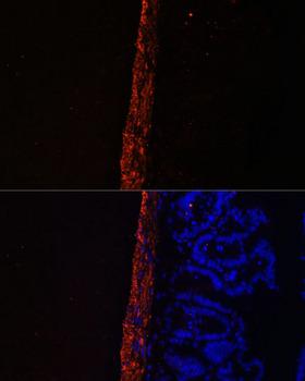 MLC2 / MYL9 Antibody - Immunofluorescence analysis of Mouse intestine using MYL9 Polyclonal Antibody at dilution of 1:100.Blue: DAPI for nuclear staining.