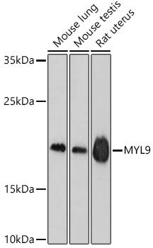 MLC2 / MYL9 Antibody - Western blot analysis of extracts of various cell lines using MYL9 Polyclonal Antibody at dilution of 1:1000.