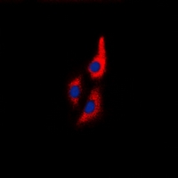 MLC2 / MYL9 Antibody - Immunofluorescent analysis of MYL9 staining in Jurkat cells. Formalin-fixed cells were permeabilized with 0.1% Triton X-100 in TBS for 5-10 minutes and blocked with 3% BSA-PBS for 30 minutes at room temperature. Cells were probed with the primary antibody in 3% BSA-PBS and incubated overnight at 4 deg C in a humidified chamber. Cells were washed with PBST and incubated with a DyLight 594-conjugated secondary antibody (red) in PBS at room temperature in the dark. DAPI was used to stain the cell nuclei (blue).