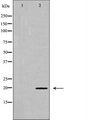 MLC2 / MYL9 Antibody - Western blot analysis of Myosin regulatory light chain 2 (Phospho-Ser18) expression in K562 cells extract. The lane on the left is treated with the antigen-specific peptide.
