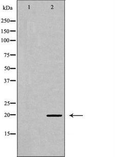 MLC2 / MYL9 Antibody - Western blot analysis of Myosin regulatory light chain 2 (Phospho-Ser18) expression in K562 cells extract. The lane on the left is treated with the antigen-specific peptide.