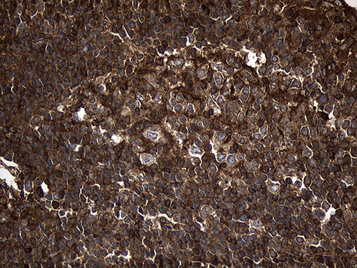MLC3F / MYL1 Antibody - Immunohistochemical staining of paraffin-embedded Human tonsil within the normal limits using anti-MYL1 mouse monoclonal antibody. (Heat-induced epitope retrieval by 1mM EDTA in 10mM Tris buffer. (pH8.5) at 120°C for 3 min. (1:2000)