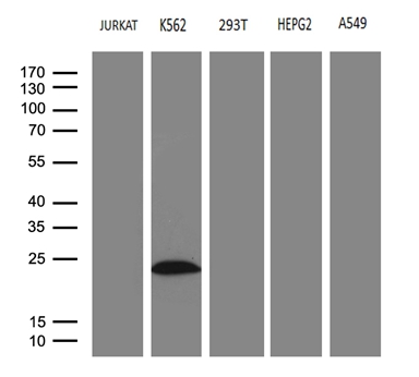 MLC3F / MYL1 Antibody - Western blot analysis of extracts. (35ug) from 5 different cell lines by using anti-MYL1 monoclonal antibody. (1:500)