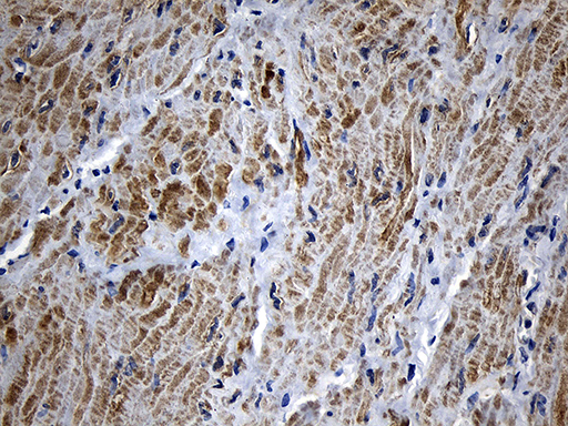 MLC3F / MYL1 Antibody - Immunohistochemical staining of paraffin-embedded Human bladder tissue within the normal limits using anti-MYL1 mouse monoclonal antibody. (Heat-induced epitope retrieval by 1mM EDTA in 10mM Tris buffer. (pH8.5) at 120°C for 3 min. (1:500)