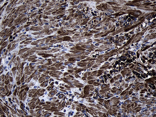 MLC3F / MYL1 Antibody - Immunohistochemical staining of paraffin-embedded Human prostate tissue within the normal limits using anti-MYL1 mouse monoclonal antibody. (Heat-induced epitope retrieval by 1mM EDTA in 10mM Tris buffer. (pH8.5) at 120°C for 3 min. (1:500)