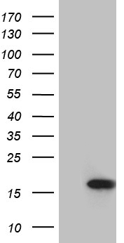 MLC3F / MYL1 Antibody - HEK293T cells were transfected with the pCMV6-ENTRY control. (Left lane) or pCMV6-ENTRY MYL1. (Right lane) cDNA for 48 hrs and lysed