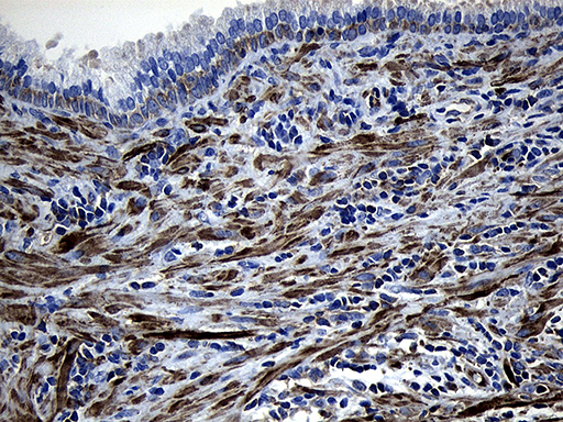 MLC3F / MYL1 Antibody - Immunohistochemical staining of paraffin-embedded Human prostate tissue within the normal limits using anti-MYL1 mouse monoclonal antibody. (Heat-induced epitope retrieval by 1mM EDTA in 10mM Tris buffer. (pH8.5) at 120°C for 3 min. (1:500)