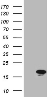 MLC3F / MYL1 Antibody - HEK293T cells were transfected with the pCMV6-ENTRY control. (Left lane) or pCMV6-ENTRY MYL1. (Right lane) cDNA for 48 hrs and lysed