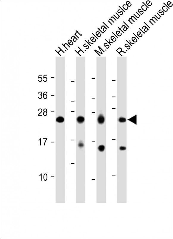 MLC3F / MYL1 Antibody - All lanes: Anti-MYL1 Antibody (Center) at 1:2000 dilution Lane 1: Human heart lysate Lane 2: Human skeletal muslce lysate Lane 3: Mouse skeletal muscle lysate Lane 4: Rat skeletal muscle lysate Lysates/proteins at 20 µg per lane. Secondary Goat Anti-Rabbit IgG, (H+L), Peroxidase conjugated at 1/10000 dilution. Predicted band size: 21 kDa Blocking/Dilution buffer: 5% NFDM/TBST.