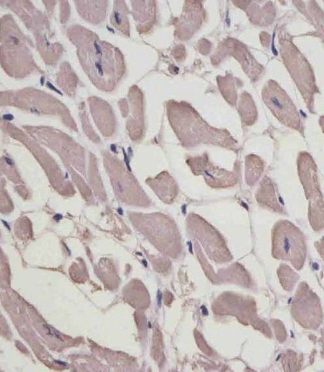 MLC3F / MYL1 Antibody - MYL1 Antibody (Center) staining MYL1 in human heart tissue sections by Immunohistochemistry (IHC-P - paraformaldehyde-fixed, paraffin-embedded sections). Tissue was fixed with formaldehyde and blocked with 3% BSA for 0. 5 hour at room temperature; antigen retrieval was by heat mediation with a citrate buffer (pH6). Samples were incubated with primary antibody (1/25) for 1 hours at 37°C. A undiluted biotinylated goat polyvalent antibody was used as the secondary antibody.