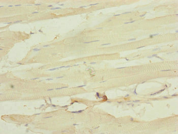 MLC3F / MYL1 Antibody - Immunohistochemistry of paraffin-embedded human skeletal muscle tissue at dilution of 1:100