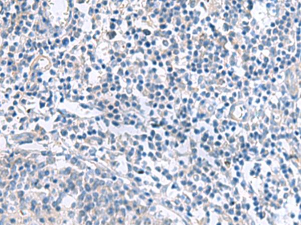 MLC3F / MYL1 Antibody - Immunohistochemistry of paraffin-embedded Human tonsil tissue  using MYL1 Polyclonal Antibody at dilution of 1:50(×200)