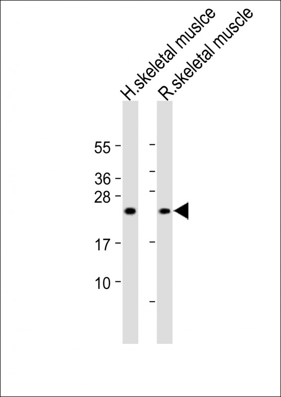 MLC3F / MYL1 Antibody - All lanes: Anti-MYL1 Antibody (N-Term) at 1:2000 dilution Lane 1: Human skeletal muslce lysate Lane 2: Rat skeletal muscle lysate Lysates/proteins at 20 µg per lane. Secondary Goat Anti-Rabbit IgG, (H+L), Peroxidase conjugated at 1/10000 dilution. Predicted band size: 21 kDa Blocking/Dilution buffer: 5% NFDM/TBST.