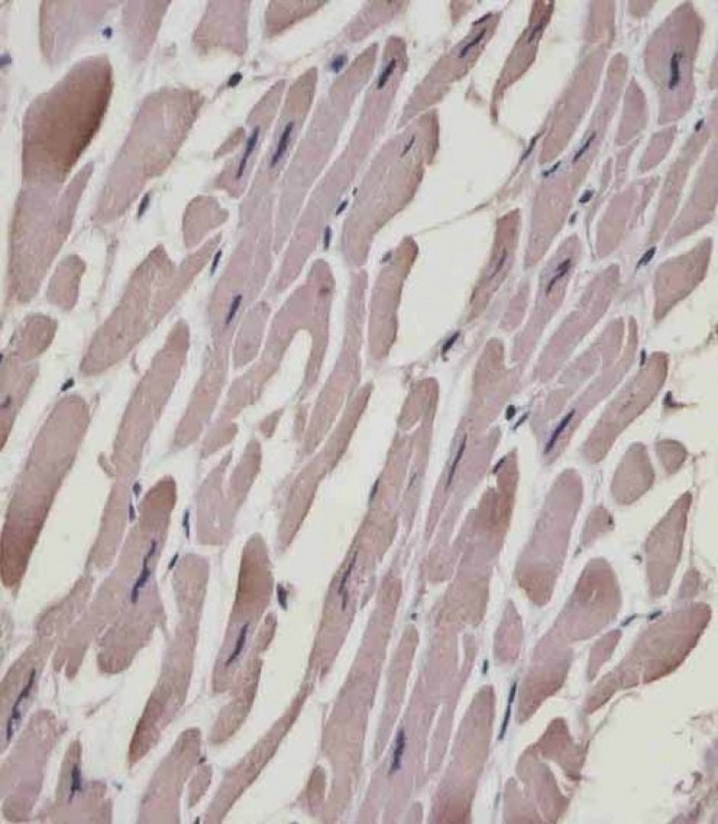 MLC3F / MYL1 Antibody - MYL1 Antibody (N-Term) staining MYL1 in human heart tissue sections by Immunohistochemistry (IHC-P - paraformaldehyde-fixed, paraffin-embedded sections). Tissue was fixed with formaldehyde and blocked with 3% BSA for 0. 5 hour at room temperature; antigen retrieval was by heat mediation with a citrate buffer (pH6). Samples were incubated with primary antibody (1/25) for 1 hours at 37°C. A undiluted biotinylated goat polyvalent antibody was used as the secondary antibody.