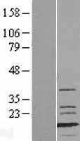 MLC3F / MYL1 Protein - Western validation with an anti-DDK antibody * L: Control HEK293 lysate R: Over-expression lysate