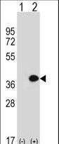MLF1 Antibody - Western blot of MLF1 (arrow) using rabbit polyclonal MLF1 Antibody. 293 cell lysates (2 ug/lane) either nontransfected (Lane 1) or transiently transfected (Lane 2) with the MLF1 gene.