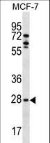 MLF1 Antibody - MLF1 Antibody western blot of MCF-7 cell line lysates (35 ug/lane). The MLF1 antibody detected the MLF1 protein (arrow).