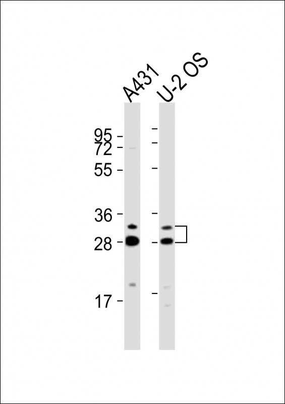 MLF1 Antibody - All lanes : Anti-MLF1 Antibody at 1:2000 dilution Lane 1: A431 whole cell lysates Lane 2: U-2 OS whole cell lysates Lysates/proteins at 20 ug per lane. Secondary Goat Anti-Rabbit IgG, (H+L), Peroxidase conjugated at 1/10000 dilution Predicted band size : 31 kDa Blocking/Dilution buffer: 5% NFDM/TBST.
