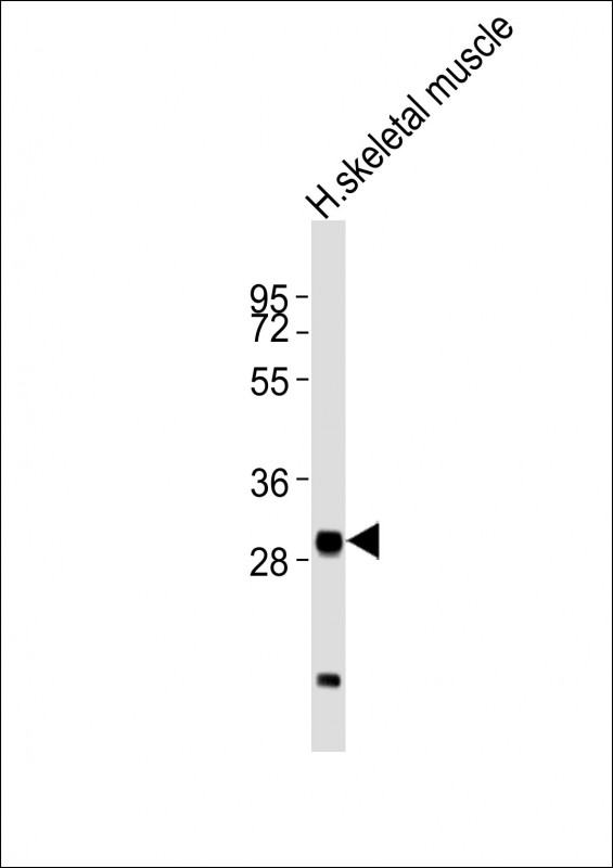 MLF1 Antibody - Anti-MLF1 Antibody at 1:2000 dilution + human skeletal muscle lysates Lysates/proteins at 20 ug per lane. Secondary Goat Anti-Rabbit IgG, (H+L), Peroxidase conjugated at 1/10000 dilution Predicted band size : 31 kDa Blocking/Dilution buffer: 5% NFDM/TBST.