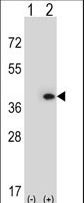 MLF1 Antibody - Western blot of MLF1 (arrow) using rabbit polyclonal MLF1 Antibody. 293 cell lysates (2 ug/lane) either nontransfected (Lane 1) or transiently transfected (Lane 2) with the MLF1 gene.