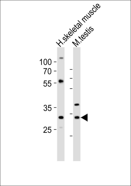 MLF1 Antibody - Western blot of lysates from human skeletal muscle, mouse testis tissue lysate (from left to right) with Mlf1 Antibody. Antibody was diluted at 1:1000 at each lane. A goat anti-rabbit IgG H&L (HRP) at 1:10000 dilution was used as the secondary antibody. Lysates at 20 ug per lane.