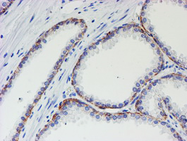MLF1 Antibody - IHC of paraffin-embedded Human prostate tissue using anti-MLF1 mouse monoclonal antibody.