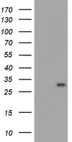 MLF1 Antibody - HEK293T cells were transfected with the pCMV6-ENTRY control (Left lane) or pCMV6-ENTRY MLF1 (Right lane) cDNA for 48 hrs and lysed. Equivalent amounts of cell lysates (5 ug per lane) were separated by SDS-PAGE and immunoblotted with anti-MLF1.