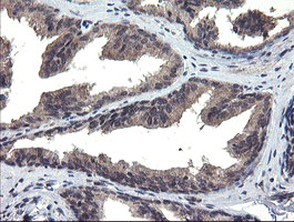 MLF1 Antibody - IHC of paraffin-embedded Human prostate tissue using anti-MLF1 mouse monoclonal antibody.