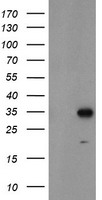 MLF1 Antibody - HEK293T cells were transfected with the pCMV6-ENTRY control (Left lane) or pCMV6-ENTRY MLF1 (Right lane) cDNA for 48 hrs and lysed. Equivalent amounts of cell lysates (5 ug per lane) were separated by SDS-PAGE and immunoblotted with anti-MLF1.