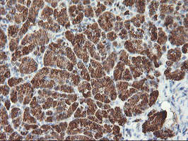 MLF1 Antibody - IHC of paraffin-embedded Human pancreas tissue using anti-MLF1 mouse monoclonal antibody.