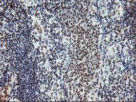 MLF1 Antibody - IHC of paraffin-embedded Human tonsil using anti-MLF1 mouse monoclonal antibody.