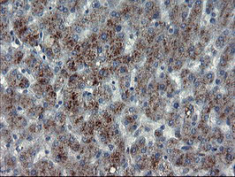 MLF1 Antibody - IHC of paraffin-embedded Human liver tissue using anti-MLF1 mouse monoclonal antibody. (Heat-induced epitope retrieval by 10mM citric buffer, pH6.0, 100C for 10min).