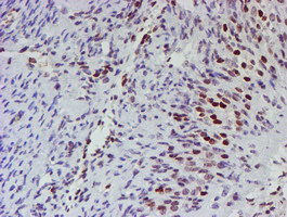 MLF1 Antibody - IHC of paraffin-embedded Human Ovary tissue using anti-MLF1 mouse monoclonal antibody.