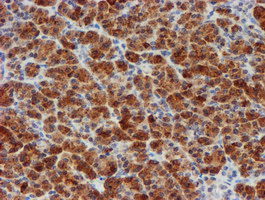 MLF1 Antibody - IHC of paraffin-embedded Human pancreas tissue using anti-MLF1 mouse monoclonal antibody.